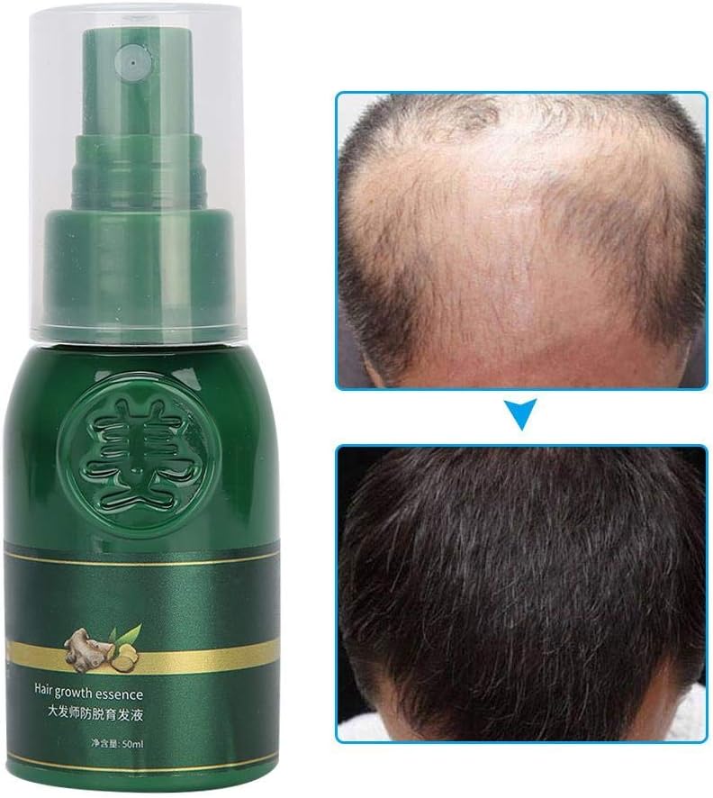 بخاخ ShougaGRO الياباني لنمو الشعر